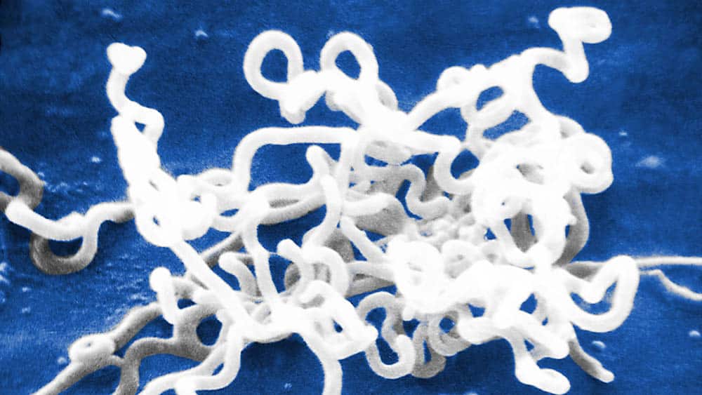 Imagem de microscópio da bactéria causadora da sífilis.