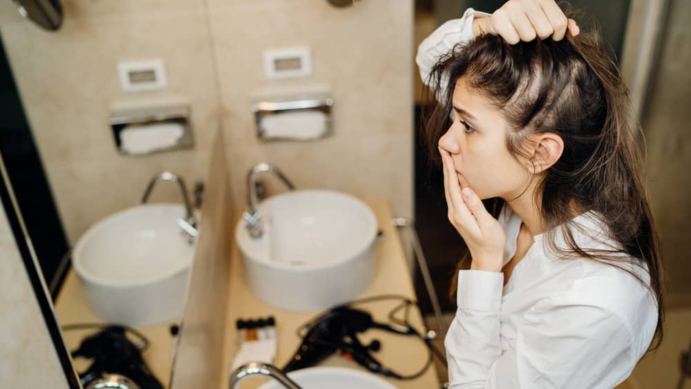 Tratamento da alopecia areata não é obrigatório, porque não previne recidivas, mas é recomendado para evitar distúrbios psicológicos.