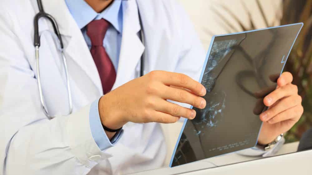 médico analisa mamografia. obesidade sedentarismo e câncer de mama têm relação