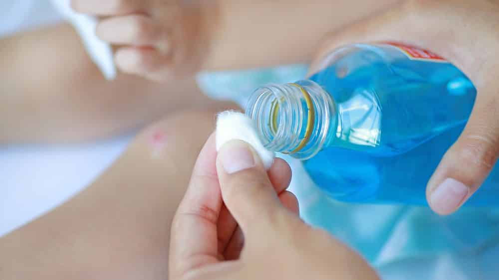 close em mão de mulher com produto para limpar machucados no joelho de criança