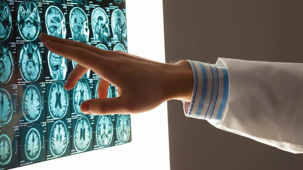 close de mão de médico apontando para tomografia de cérebro. estudo mostra relação entre memória e imaginação