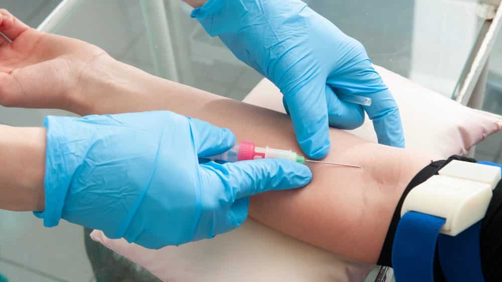 close em braço de paciente tirando sangue. exame faz parte da estratégia para erradicar a aids