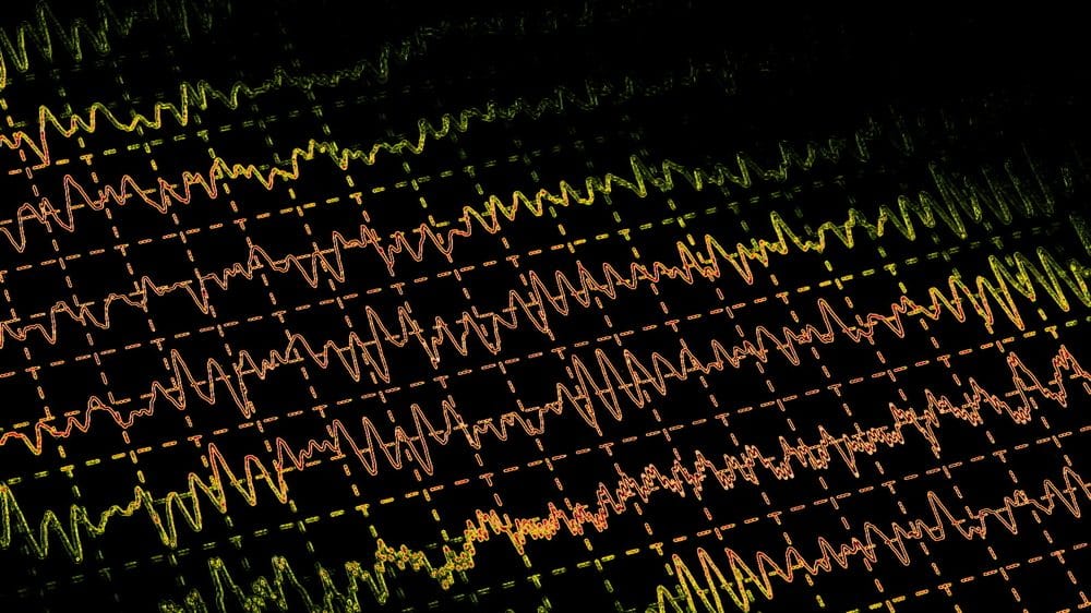 ondas cerebrais em monitor. morte cerebral obedece a critérios específicos