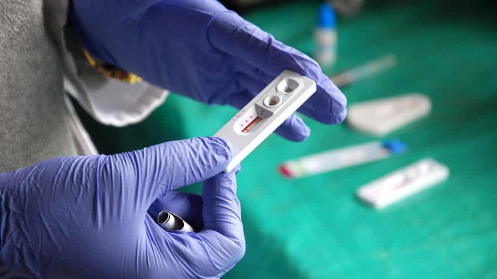 close de médico com luva avaliando teste de HIV. Veja os novos números da aids