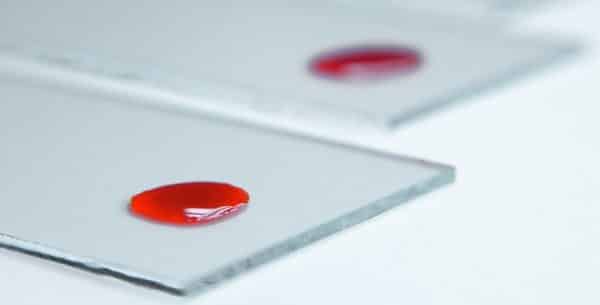 Tratamento da hepatite C | Artigo Tratamento da hepatite C | Artigo