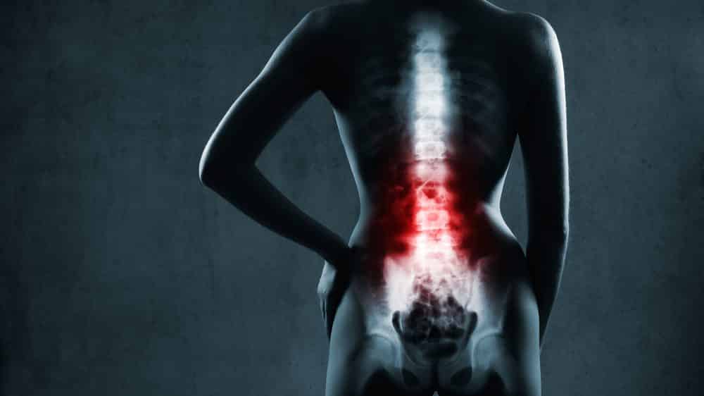 desenho de coluna vertebral em 3D. Traumas na coluna causam lesões graves.