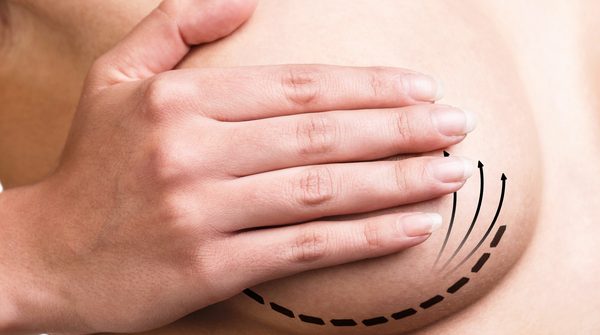 Tratamento hormonal do câncer de mama | Artigo Tratamento hormonal do câncer de mama | Artigo