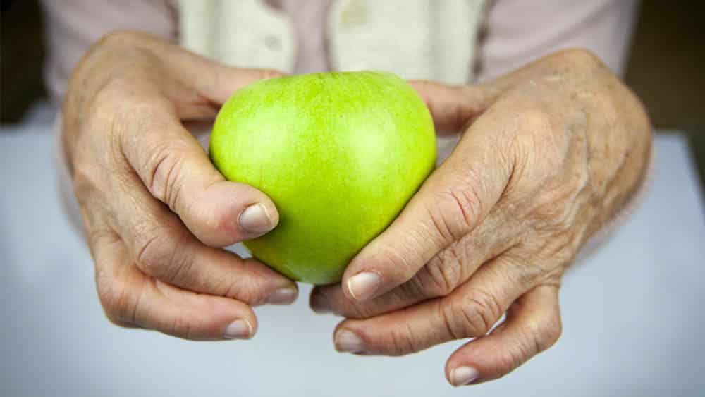 Reumatismo | Entrevista Close em mãos de mulher mais velha com deformidades de artrite segurando uma maçã verde.