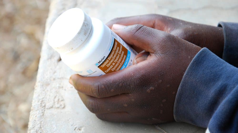 foco em mãos de menino segurando frasco com antirretrovirais, que também fazem parte da estratégia de prevenção do HIV