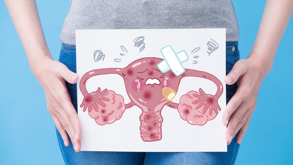 Câncer de endométrio é um dos tumores ginecológicos mais frequentes que acomete principalmente mulheres na pós-menopausa, depois dos 60 anos.