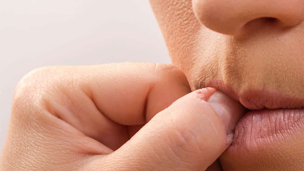 Close em boca de mulher mordendo unha sinalizando ansiedade.