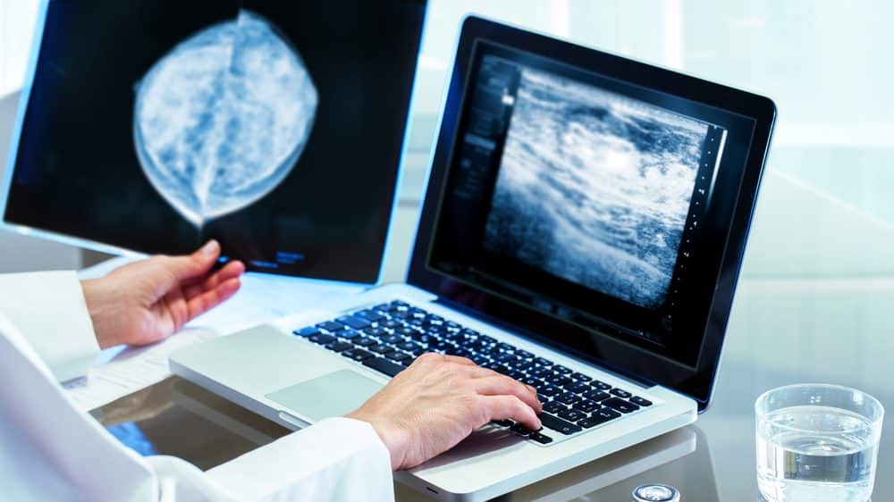 Reflexões sobre o câncer de mama | Artigo médico examina mamografia, um dos principais exames de diagnóstico do câncer de mama