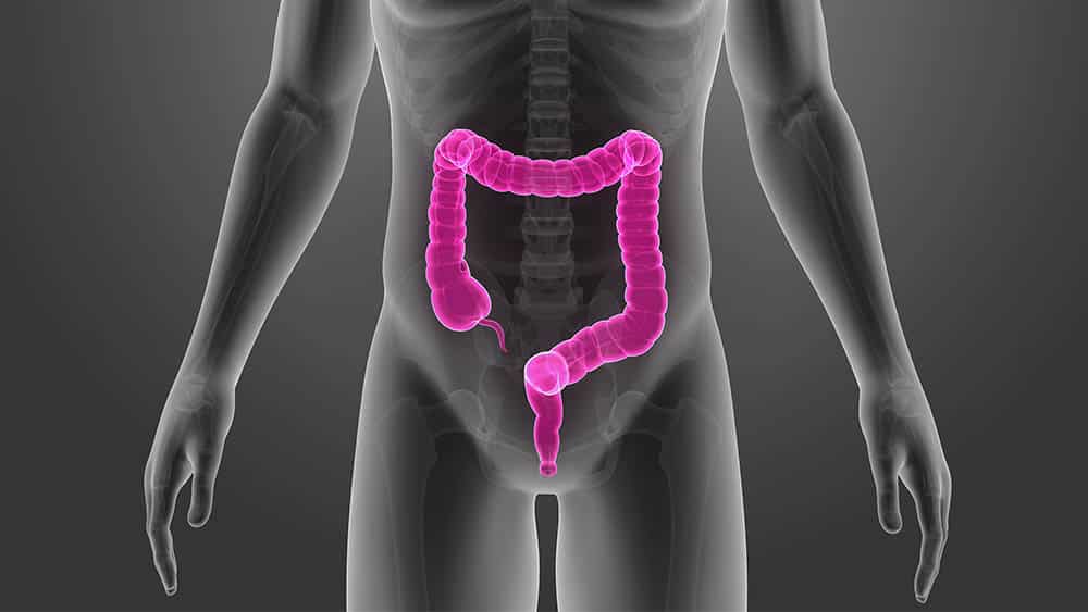 Ilustração de silhueta de abdômen humano com intestino grosso em destaque.