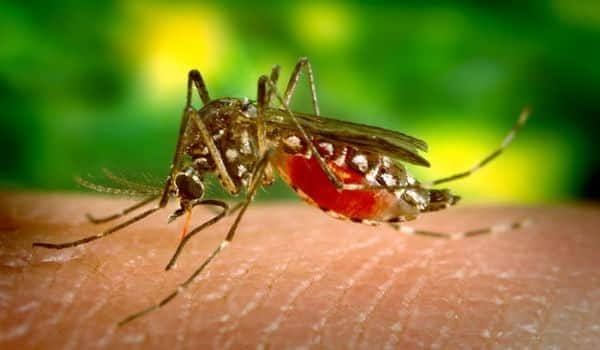 zika vÃ­rus microcefalia