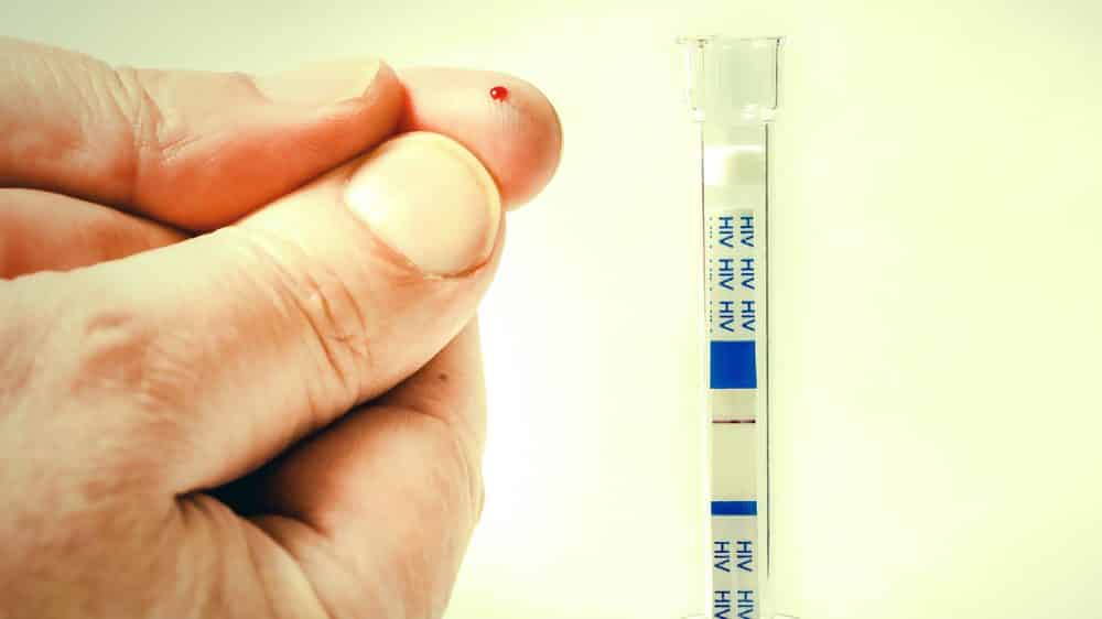 close em dedo furado e em autoteste para HIV. tratamento precoce da aids é mais eficiente