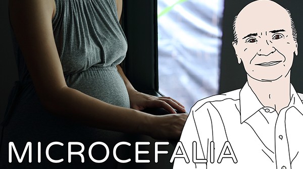 Microcefalia | Coluna #34 microcefalia