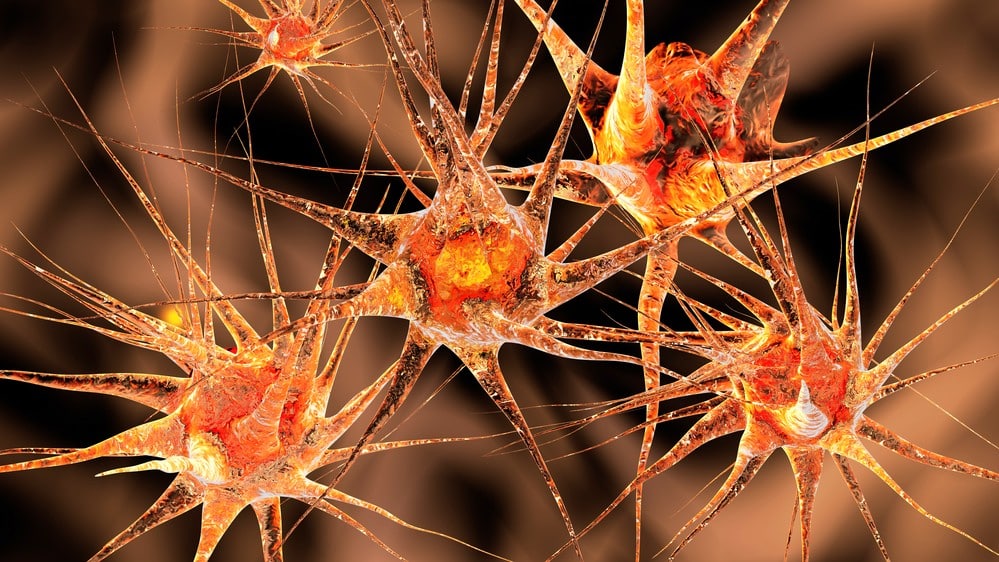 rede neural em 3D. Estimulação cerebral profunda ajuda a tratar várias doenças