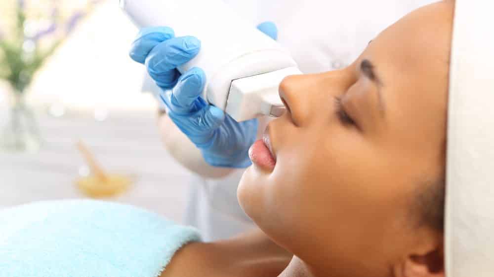 mulher depilando buço com laser