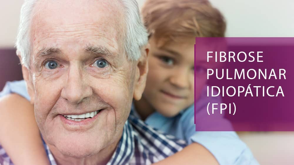 Fibrose pulmonar idiopática | Especial thumb fpi tab hotsite fibrose pulmonar idiopatica