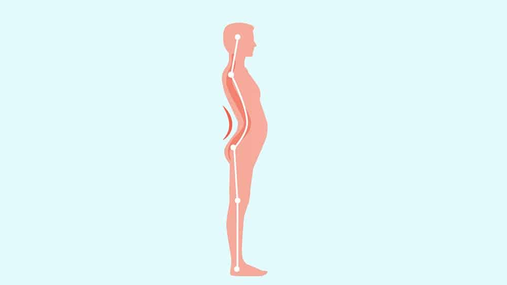 Ilustração de perfil de pessoa com lordose.