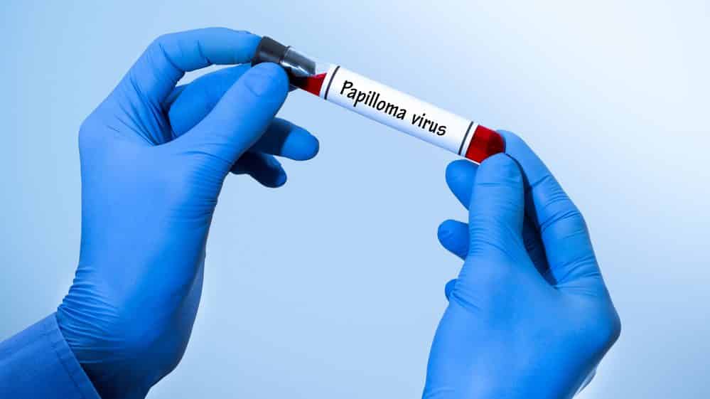 Mãos com luvas azuis segurando um tubo com amostra de sangue e etiqueta escrito papilomavírus.