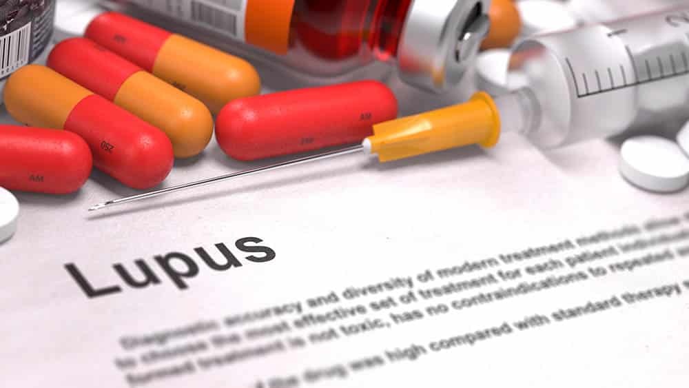 lupus