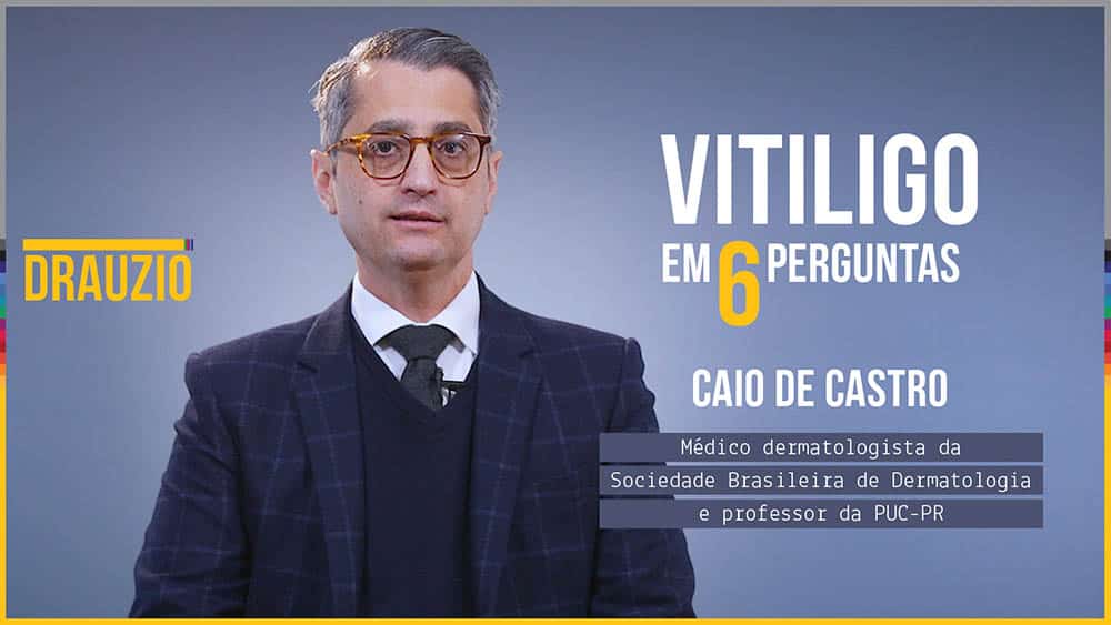thumb x perguntas vitiligo