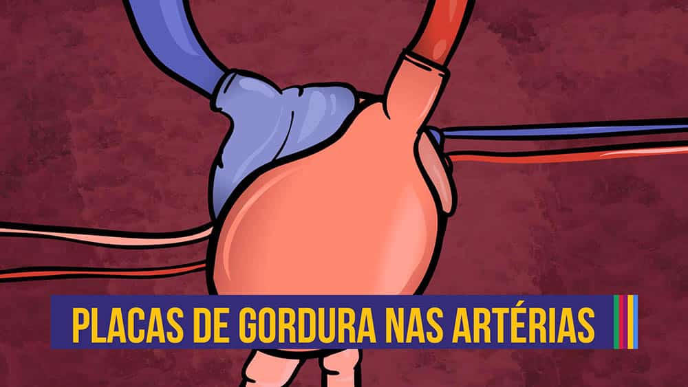 Como se formam as placas de gordura | Animação #08 thumb anima colesterol placas gordura