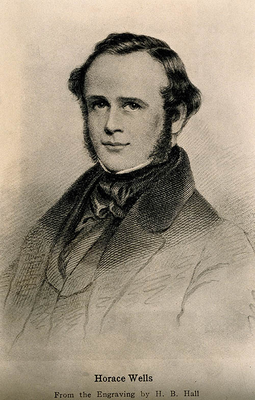 anestesia horace wells