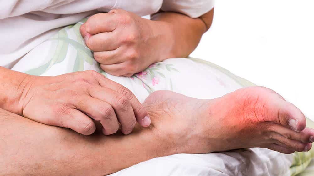 Homem com perna cruzada e destaque vermelho próximo do dedão do pé indicando inflamação.