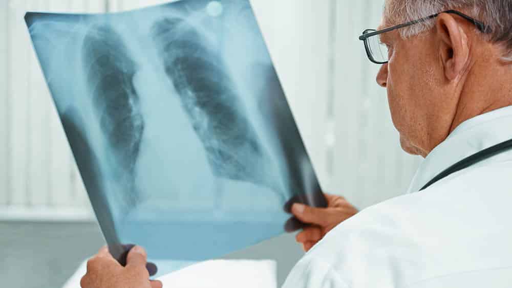 Médico segurando e analisando radiografia de tórax.