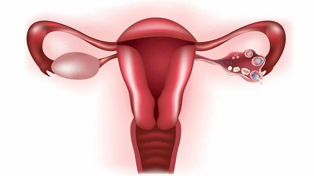 Ilustração digital de sistema reprodutor feminino com óvulos sendo liberados do ovário.
