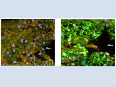Imagem de microscópio comparando aedes aegypti comvírus da dengue e mosquito com Wolbachia, sem o vírus.