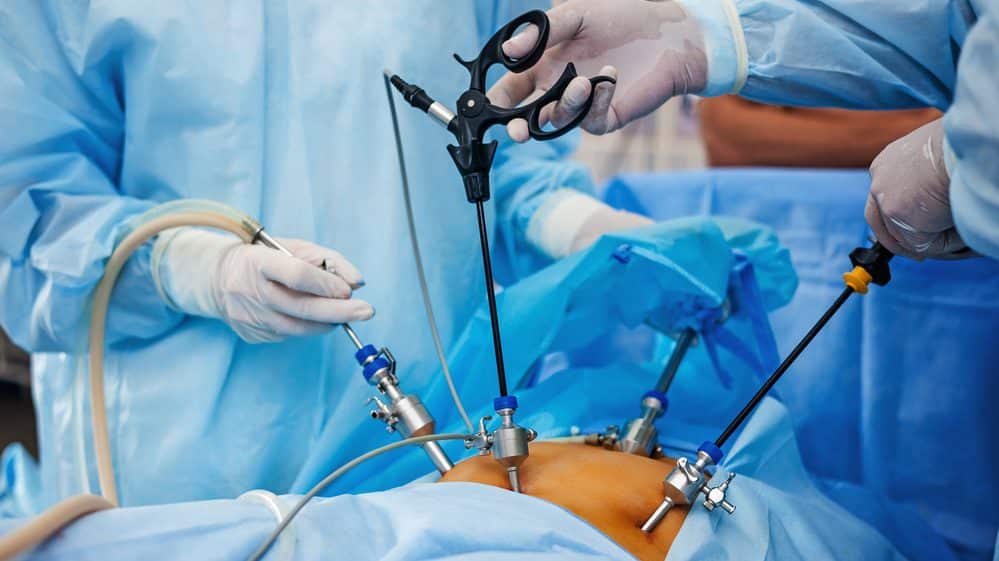 cirurgia bariátrica feita por laparoscopia pode ser a cura do diabetes