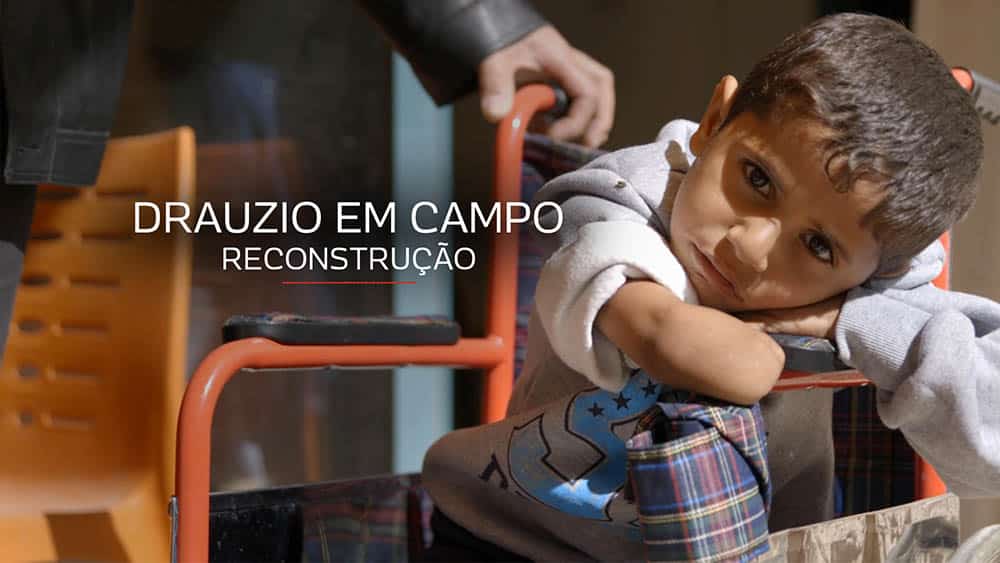 Menino refugiado sírio sem o antebraço direito olhando para a câmera com expressão triste.