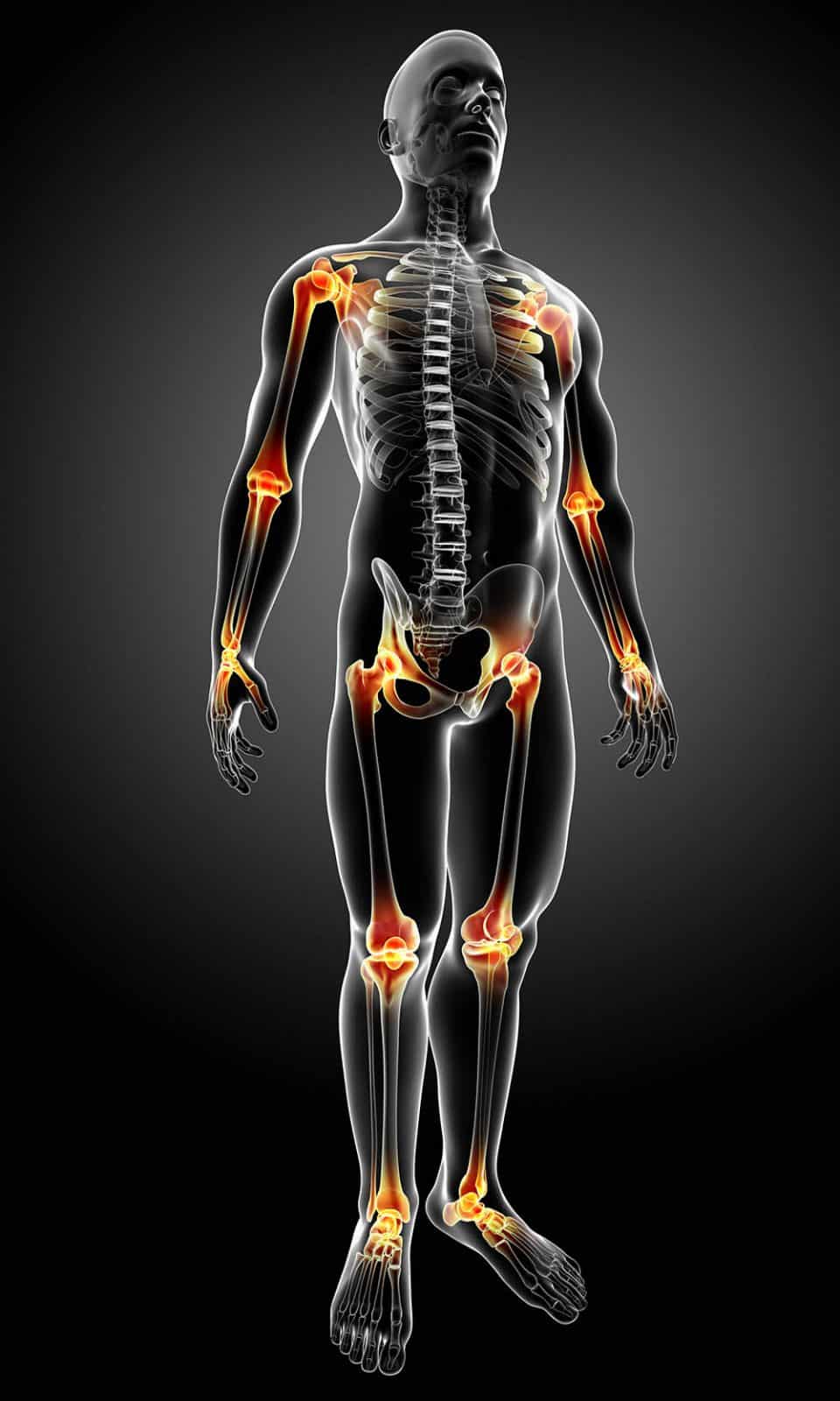 Ilustração de corpo humano masculino com principais pontos de dor articular destacadas.