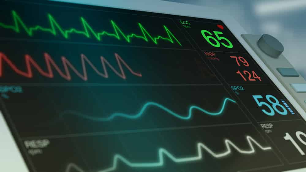 monitor cardíaco. relação entre mortalidade e coronavírus no Brasil é complexa