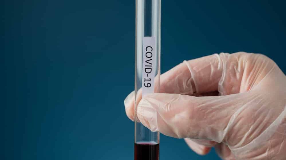 mão de cientista com luva segurando tubo de ensaio com sangue onde se lê covil-19. Veja as dúvidas sobre o novo coronavírus